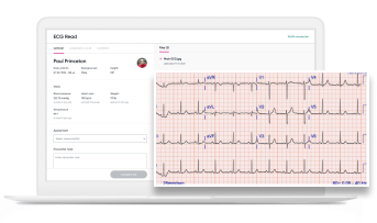 ECG Reads